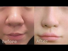 10 मिनट में मोटी और बड़ी नाक को बनाइए सुंदर और आकर्षक। How to get rid big nose, beautiful nose - YouTube Nose Beautiful, Best Foods For Skin, Beautiful Nose, Nose Reshaping, Big Nose Beauty, Straight Nose, Face Yoga Facial Exercises, Perfect Nose, Face Exercises