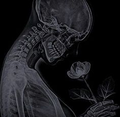 an x - ray image of a skeleton holding a rose