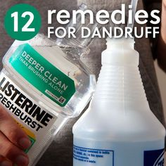 12 Dandruff Remedies- to get rid of the flakes.... would not try a couple of these, but some of them sound very interesting and helpful!!! Home Remedies For Dandruff, Hair Remedies, Homemade Beauty Products