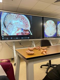 two large screens displaying brain images in an office