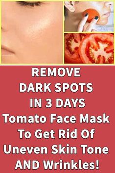 5 Ways to Deal with Dry Skin Tomato For Skin, Tomato Face Mask, Tomato Face, Remedies For Glowing Skin, Treating Hyperpigmentation, Natural Mask, Face Care Tips, Dark Spots On Skin, Shiny Skin