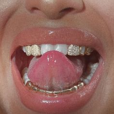 Diamond Teeth, Dope Jewelry Accessories, Grills Teeth, Tooth Gem