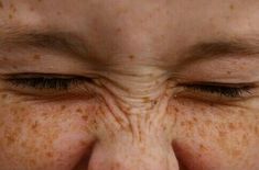 the eyes of a woman with freckles on her face