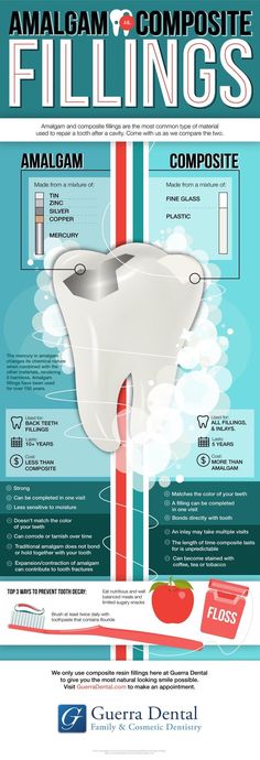 Composite Fillings, Dental Hygiene Student, Kedokteran Gigi, Dental Fillings