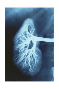 an x - ray shows the heart and lungs