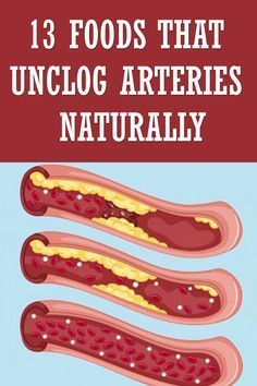 Unclog Arteries, Daily Health Tips, Beach Hacks, Good Health Tips, Healthy Eating Tips, Health Check, Lifestyle Tips, Health And Fitness Tips