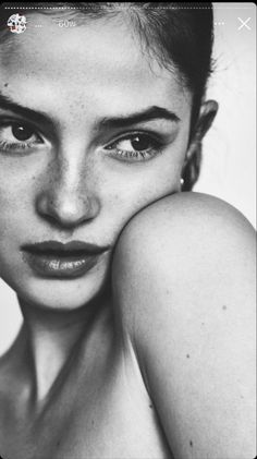 a black and white photo of a woman with freckles on her face, looking at the camera