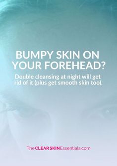 How To Get Rid Of Bumpy Skin On Your Forehead - www.TheClearSkinEssentials.com Bumpy Forehead, Tiny Bumps On Face, Bumps On Forehead, Chest Acne, Forehead Acne, Acne Face Wash, Bumpy Skin, Acne Solutions, Time To Relax