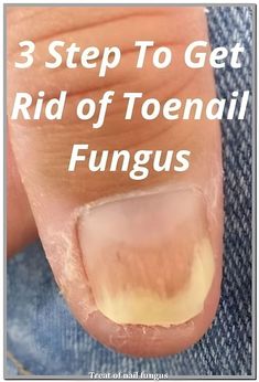 Clear Nail, Fungal Infection, Nail Fungus