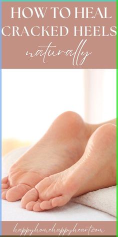 Want to know how to heal cracked heels overnight? If you want to know how to heal cracked heels fast, you need to read this! These all natural cracked heel remedies will help heal painful cracked heels. You need to check these tips out if you want to heal extremely cracked heels! Healing Cracked Heels, Cracked Heel Remedy, Cracked Feet Remedies, Age Spot Remedies, Cracked Heel Remedies, Heal Cracked Heels, Homemade Foot Scrub, Foot Soak Recipe, Diy Heels