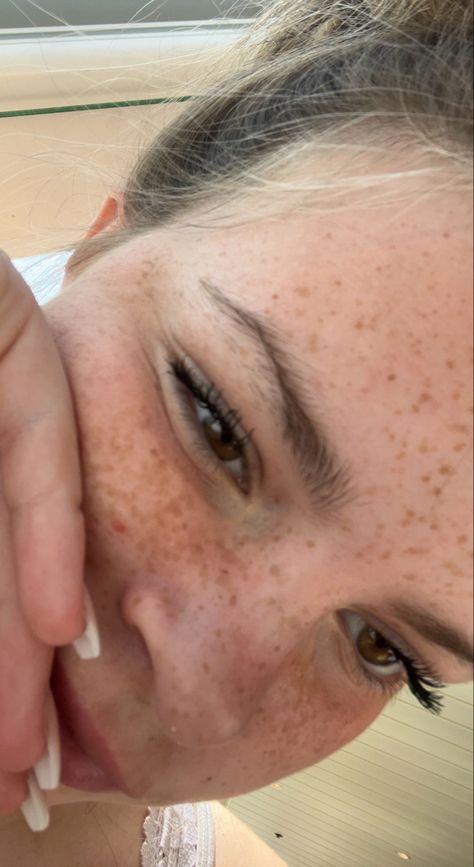 Clear Skin Freckles Face, Heavy Freckles, Natural Freckles Makeup, Pretty Freckles, Blonde Hair Freckles, Light Freckles, Freckles Aesthetic, White Freckles, Brown Hair And Freckles