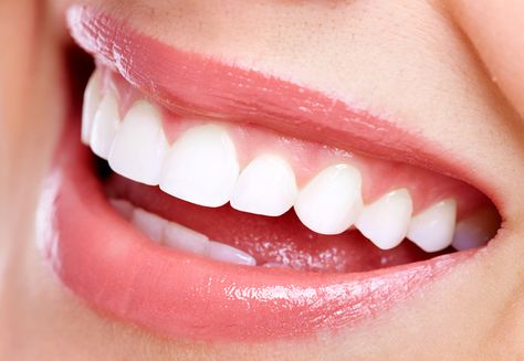 White Teeth Overnight, Make Teeth Whiter, Kedokteran Gigi, Get Whiter Teeth, Laser Teeth Whitening, Straight Teeth, Church Logo, Teeth Implants, Tooth Enamel