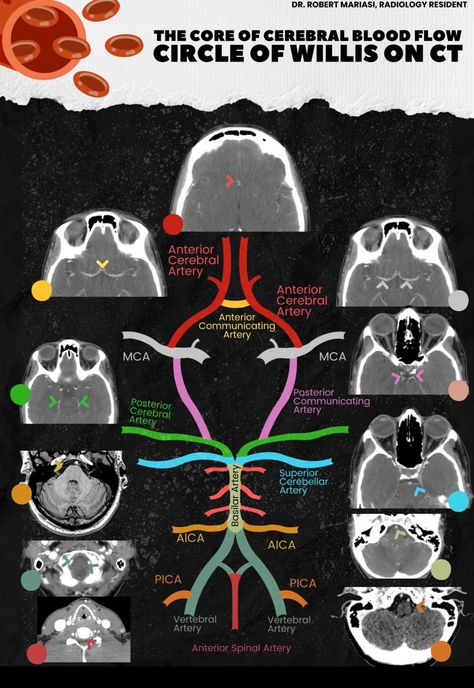 Nursing School Studying Cheat Sheets, Med Notes, Medical Radiography, Radiology Student, Medicine Notes, Medical School Life, Radiology Technologist, Basic Anatomy And Physiology, Medicine Studies