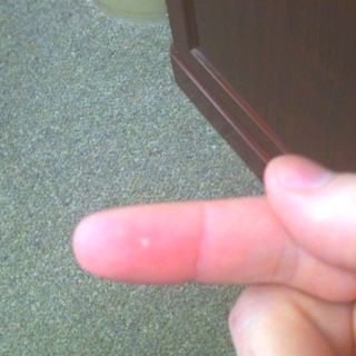 Yes that white mark is where I burned my finger putting out a match with my fingers. BTW that doesn't work. White Mark, White