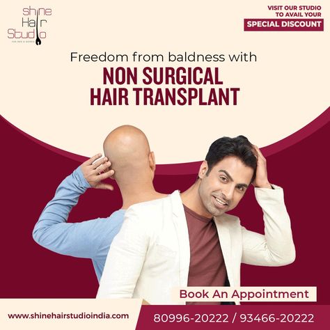 Hair Transplant Ads, Hair Implants, Hair Doctor, Hair Replacement Systems, Mens Hair Colour, Fue Hair Transplant, Hair Fixing, Aesthetic Clinic, Hair Growth Serum