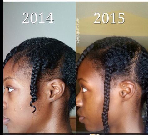 Growth Extreme Hair Growth, Natural Hair Growth Tips, Hair Growth Secrets, Hair Care Growth, Fast Hair, How To Grow Natural Hair, Extreme Hair, Grow Long Hair, Hair Treatments