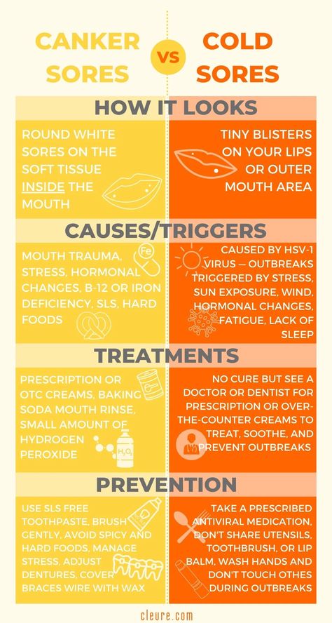 Canker Sores vs Cold Sores Infographic – Cleure Types Of Mouth, Canker Sore Causes, Ulcer Remedies Mouth, Canker Sore Remedy, Mouth Rinse, Sick Remedies, Cold Sores, Canker Sore, Cold Sores Remedies