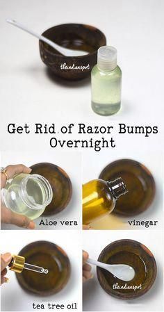 Razor burns may be treated quickly with apple cider vinegar. Its properties work to decrease the itching sensation as well as inflammation. Plus helps prevent infection. #strawberrylegstreatment Razor Bumps Remedy, Burn Remedy, Shaving Bumps, Leg Care, Textured Skin, Razor Bumps, Ingrown Hairs, Homemade Products, Homemade Beauty