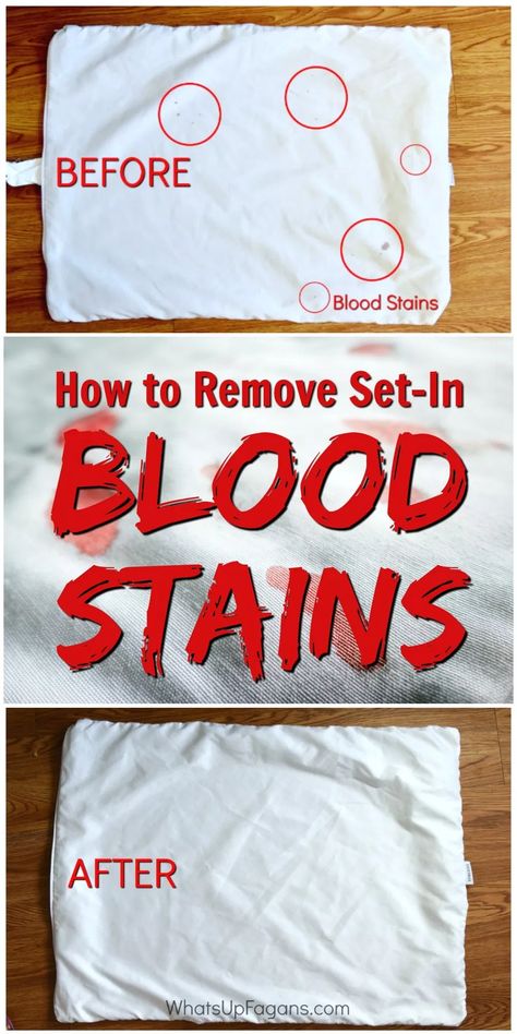 blood stain removal method with ammonia - hot iron laundry stain removal - how to get rid of blood stain on fabric, clothes, sheets, pillow case with ammonia, cleaning tutorial tip, hydrogen peroxide Get Blood Out Of Sheets, Removing Blood Stains, Homemade Toilet Cleaner, Clean Baking Pans, Fabric Clothes, Cleaning Painted Walls, Laundry Stains, Laundry Tips, Deep Cleaning Tips