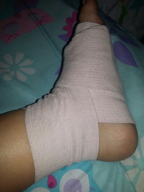 My foot😢😢😢😢😢😢 Nature, Ankle Injury Prank, Leg Bandage Snap, Leg Swelling Snapchat, Leg Fracture Snapchat Story, Fake Injury Leg Snapchat, Leg Injured Images, Knee Injury Pics, Ankle Injury Snapchat