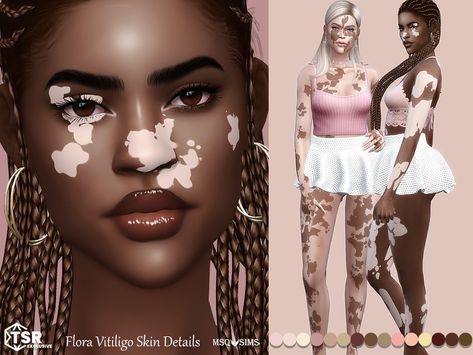 The Sims Resource - Flora Vitiligo Skin Details Sims 4 Cc Skin Details, Maxis Match Cc, Sims 4 Black Hair, Sims 4 Cas Mods, Cc Folder, The Sims 4 Skin, Makeup Cc, Skin Details, Sims 4 Cc Makeup