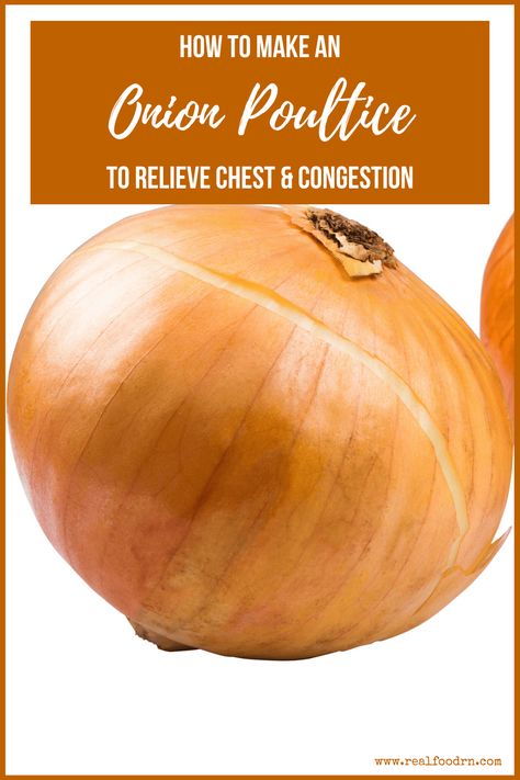 Onion Poultice, Cough Remedies For Kids, Natural Remedies For Congestion, Chest Congestion Remedies, Congestion Remedies, Best Cough Remedy, Cold And Cough Remedies, Congestion Relief, Sick Remedies