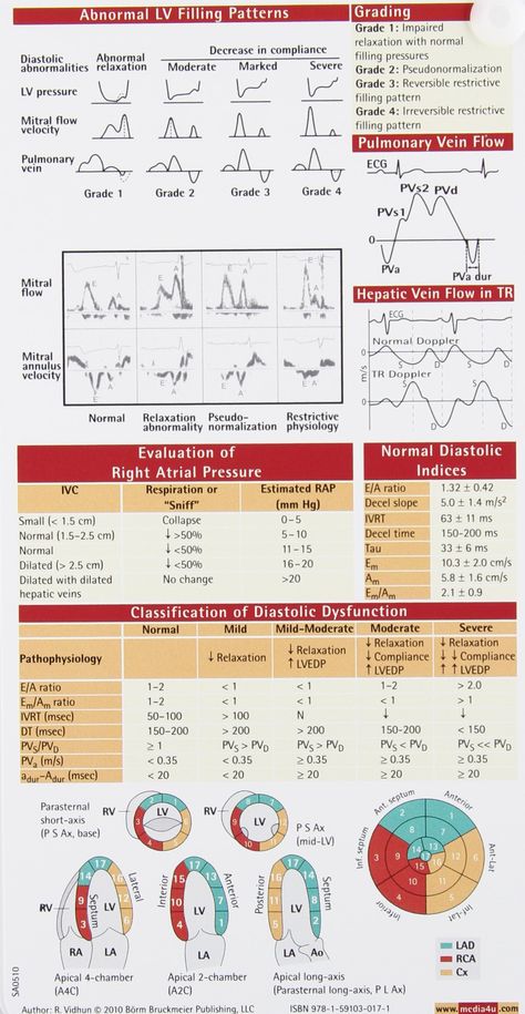 Pocket guide reviews available for purchase amazon.com Cath Lab Nursing, Diagnostic Medical Sonography Student, Cardiac Sonography, Sonography Student, Vascular Ultrasound, Ultrasound Sonography, Diagnostic Medical Sonography, Ultrasound Technician, Ultrasound Tech