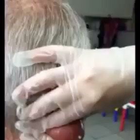 3,415 likes, 48 comments - #ifyouincyst (@ifyouincyst) on Instagram: "#pimplepopping #pimple #pimpleproblems #pimplepoppers #acne #blackheads #whiteheads #cysts #ifyou..." Pimple On Eyelid, Huge Pimple, Blind Pimple, Human Body Temperature, Sick Remedies, Dark Underarms, February 11, Keeping Healthy, Blackheads