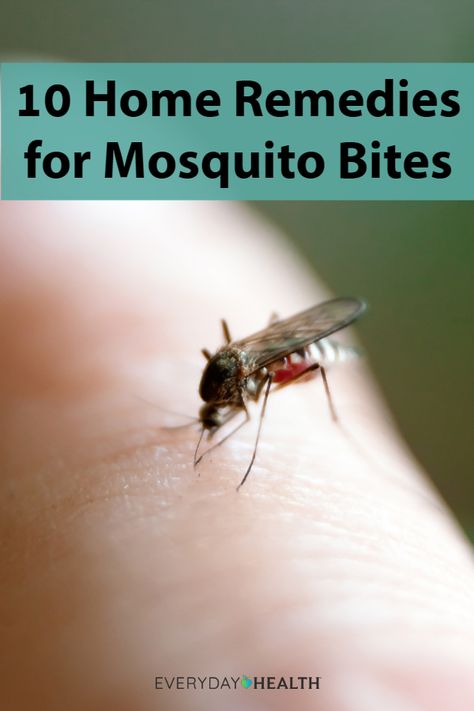 Get ready for #mosquito bite season with these home remedies. Bug Bite Swelling, Remedies For Bug Bites, Mosquito Bite Itch, Witch Hazel Acne, Itchy Bug Bites, Remedies For Mosquito Bites, Bug Bites Remedies, Dry Skin Remedies, Pure Aloe Vera