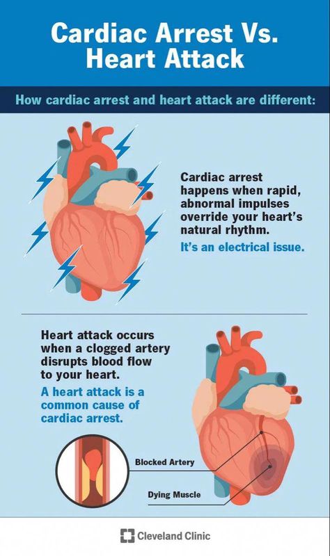 Both a heart attack and cardiac arrest can be scary and life-threatening medical conditions affecting your heart, but there are differences in how and why they occur. #HealthAndWellnessTips Summer Health, Congenital Heart Defect, Heart Function, Health And Fitness Magazine, Home Doctor, Healthy Diet Tips, Cleveland Clinic, Daily Health Tips, Fitness Advice