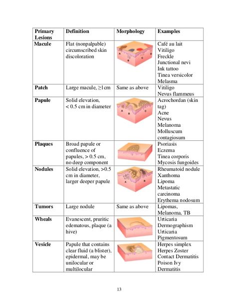 Skin Disorders Nursing, Dermatology Notes, Skin Lesions Nursing, Dermatology Medical Terms, Skin Disorders And Diseases, Dermatology Clinic, Acne Vulgaris, Medical Student Study, Student Guide