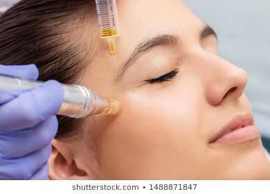 Macro close up of therapist injecting enzymes and with derma pen around woman's eyes.stock photos images Microneedling With Prp, Anti Wrinkle Injections, Derma Pen, Cosmetic Injectables, Platelet Rich Plasma, Cosmetic Clinic, Aesthetic Medicine, Aesthetic Clinic, Cosmetic Procedures