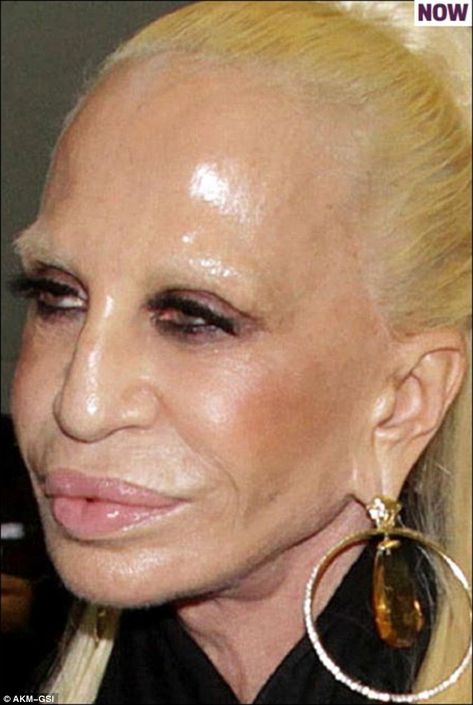 How Donatella Versace transformed herself into a human waxwork | Daily Mail Online Extreme Plastic Surgery, Plastic Surgery Photos, Tot Bag, Laser Resurfacing, Celebrity Plastic Surgery, Under The Knife, Homemade Face Masks, Donatella Versace, Homemade Face