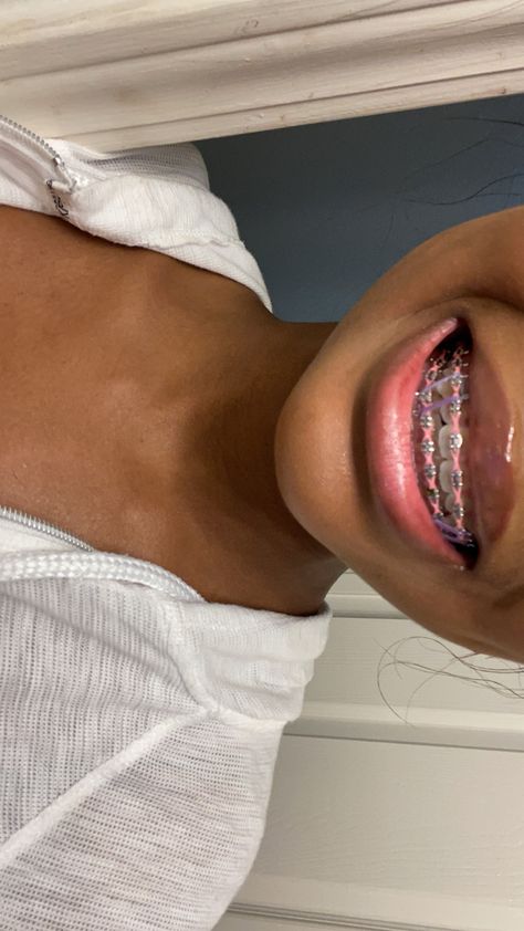 Pink braces black girls Black Powerchain Braces Colors, Braces Colors On Black Women, Braces Ideas Cute, Hot Pink Power Chain Braces, All Black Outfit With Pink Accessories, Braces Colors With Rubber Bands, Braces Vision Board, Braces Black Bands, Pretty Girl Braces