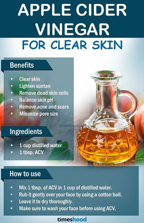 Get Clear Skin Naturally, For Clear And Glowing Skin, Apple Cider Vinegar Remedies, Apple Cider Vinegar For Skin, Clear And Glowing Skin, Clear Skin Naturally, Benefits Of Apple Cider Vinegar, Benefits Of Apple Cider, Benefits Of Apple