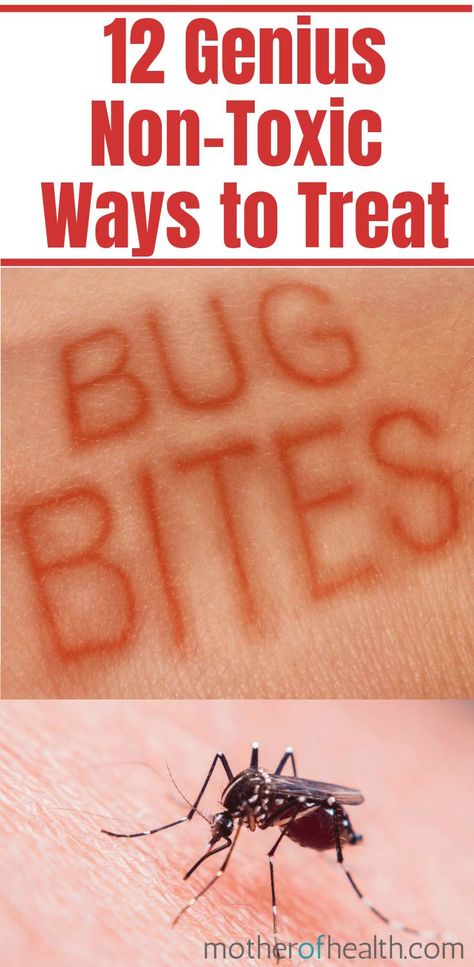 No See Ums Relief, Insect Bites Remedies, How To Get Rid Of Bug Bites Fast, How To Get Rid Of Bug Bites, Insect Bites Relief, Itchy Mosquito Bite Remedy, Home Remedy For Mosquito Bites, Spider Bites Remedies, How To Get Rid Of Mosquito Bites Fast