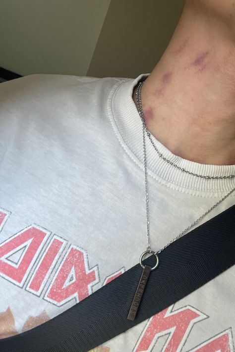 hickey boy Hickey On Boy, Hickey Neck Aesthetique, Love Bites Hickey, Neck Full Of Hickeys, Hicks On Neck, Car Outfit, This Kind Of Love, Love Bites