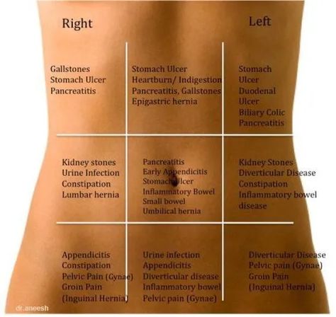 What Causes Abdominal Pain? 5 Conditions That Can Cause Stomach Problems, Depending On Location Stomach Ulcers, Stomach Pain, Abdominal Pain, Medical Education, Health Info, Health And Beauty Tips, Nurse Life, Nursing Students, Health Remedies