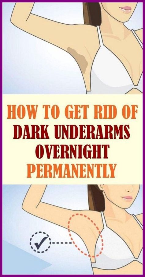 WHAT YOU WASH FIRST WHEN YOU SHOWER REVEALS HOW YOU ARE! Remedies For Dark Underarms, Whiten Underarms Fast, For Dark Underarms, How To Whiten Underarms, Dark Armpits, Dark Underarms, Natural Exfoliant, Body Odor, Skin Issues