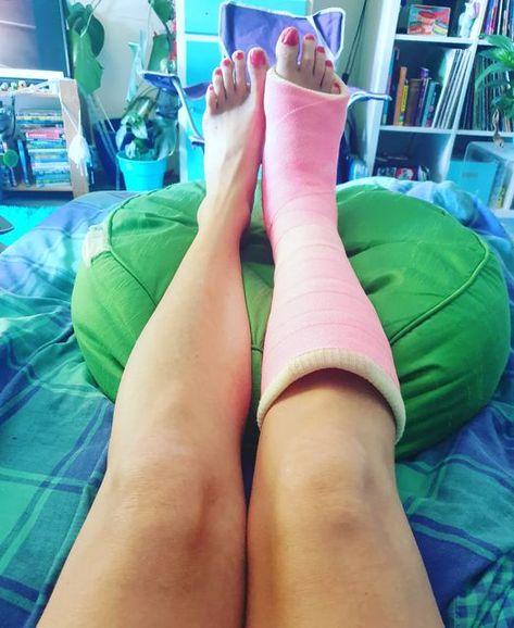 Lucy Mermaid on Instagram: "New cast and matching nails! #castlife #cast #legcast" Broken Leg Cast, Llc Cast, Long Leg Cast, Matching Nails, Leg Cast, Broken Arm, Broken Leg, Mermaid, It Cast