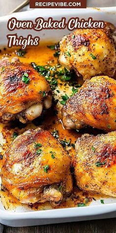 Easy Baked Chicken Thighs, Best Chicken Thigh Recipe, Cooking Chicken Thighs, Chicken Thighs Dinner, Easy Oven Baked Chicken, Oven Baked Chicken Thighs, Juicy Baked Chicken, Flavorful Dinner, Chicken Thighs Recipe