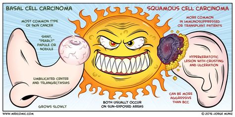 Nclex Mnemonics, Medical Mnemonics, Med Surg Nursing, Nursing Assessment, Basal Cell, Squamous Cell, Nursing Mnemonics, Nursing Care Plan, Pa School