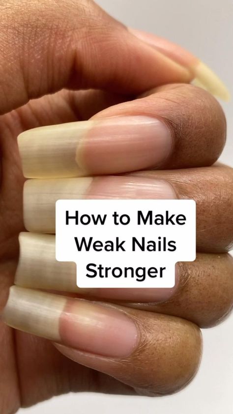 Nails Stronger, Grow Long Nails, Nail Growth Tips, Sunburn Remedies, Weak Nails, Nail Care Tips, Nail Care Routine, How To Grow Nails, Nail Growth