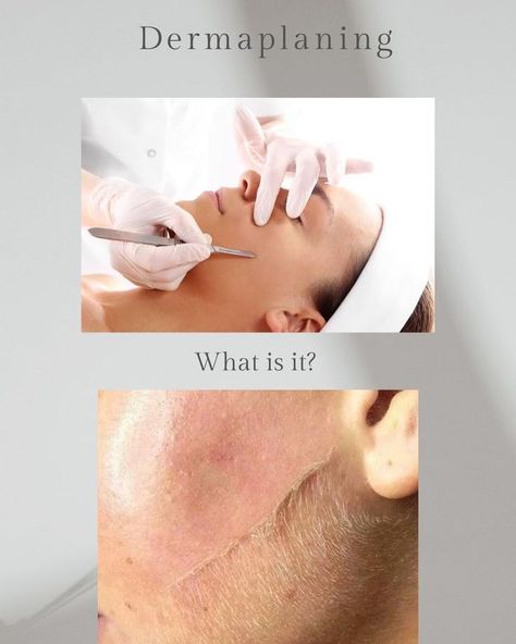 Facial Dermaplaning, Skin Esthetician, Dermaplaning Facial, Clinic Room, Esthetician Life, Esthetician Inspiration, Skin Care Center, Skin And Hair Clinic, Advertising Pictures