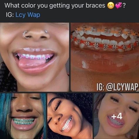 Baddie Braces Colors, Aesthetic Braces Colors Ideas, Pretty Braces Colors, Braces Colors Aesthetic, Black Girls With Braces, Lunch Ideas For Work Healthy, Brace Colors, Dental Braces Colors, Braces Colors Combinations