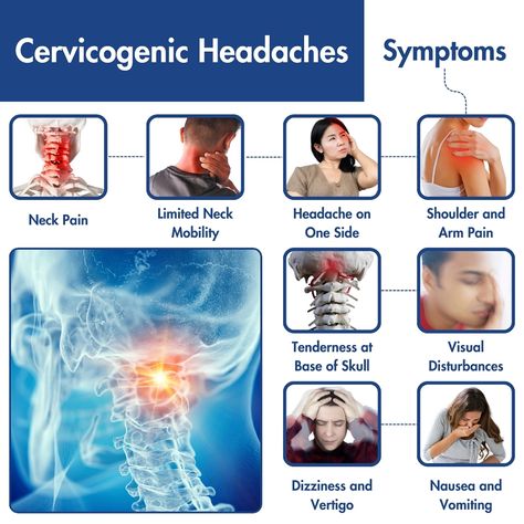 Can Neck pain cause headaches?
Neck pain can cause headaches: 
Cervicogenic headache
A chronic headache that originates in the neck and can radiate from an injury or condition in the cervical spine, such as arthritis or a slipped disk.
Tension headache
A headache that occurs when the neck and scalp muscles contract or become tense. 
Pinched nerve
A pinched nerve in the neck can cause a throbbing headache
Poor posture
Poor posture can strain muscles and tendons, Headache Chart, Cervicogenic Headache, Neck Headache, Sunflower Nail, Sunflower Nail Art, Throbbing Headache, Cervical Spondylosis, Pinched Nerve, Sunflower Nails