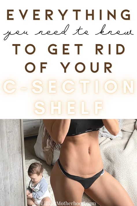 Workout For C Section Pouch, Lose Baby Weight After C Section, Get Rid Of C Section Pouch, C Section Overhang Belly, Recovery After C Section, C Section Pooch, C Section Shelf, Belly After C Section, C Section Recovery Essentials