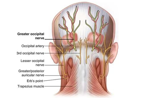 The Ultimate Guide to the Suboccipital Muscles - Iron Neck Neck Strengthening, Severe Neck Pain, Neck Training, Whiplash Injury, Head Muscles, Muscle Stretches, Neck Injury, Neck Exercises, The Dentist