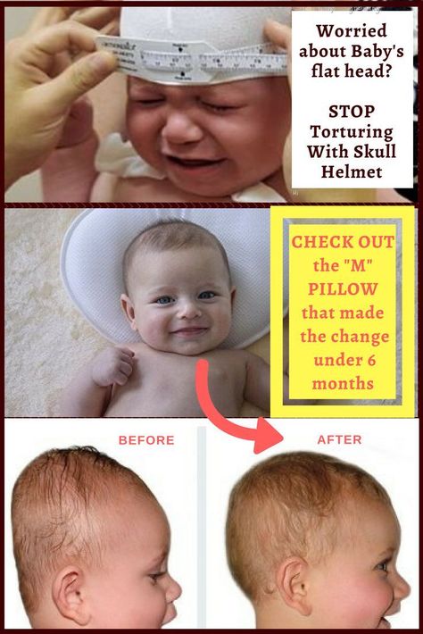 Do You Really need baby flat head helmet ? Flat spots in baby head is a common problem. How do you handle baby flat head without clunky flat head helmet that irritates baby?   This baby pillow has made the change easily without even trying. #flatheadpillow #babyflathead #Plagiocephaly Baby Head Shape, Flat Head Pillow, Flat Head Baby, Flat Head Syndrome, Baby Helmet, Skull Helmet, Baby Spa, Infant Adoption, Baby Pillow