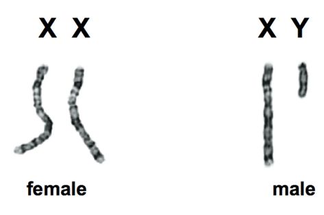 What is the Difference Between Swyer Syndrome and Androgen Insensitivity 1 Male Vs Female, X Chromosome, Scar Tissue, Human Male, Biology, Thing 1, Science, Human